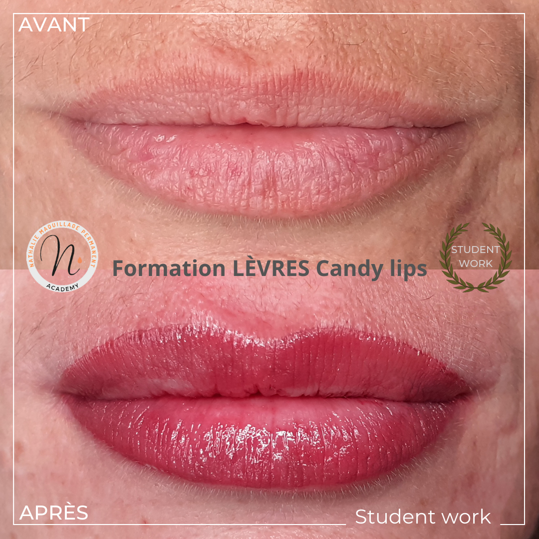 Formation candy lips