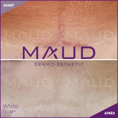 White scar siteweb 2 800x800 3